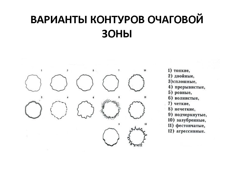 ВАРИАНТЫ КОНТУРОВ ОЧАГОВОЙ ЗОНЫ